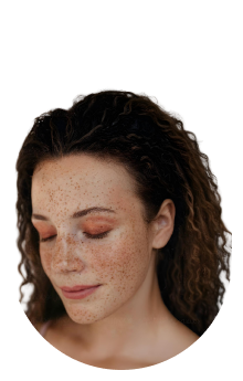 Freckles icon