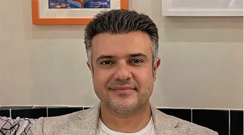 تصویر بعد از کلینیک تخصصی کاشت مو در شیراز | دکتر احسان صالح
